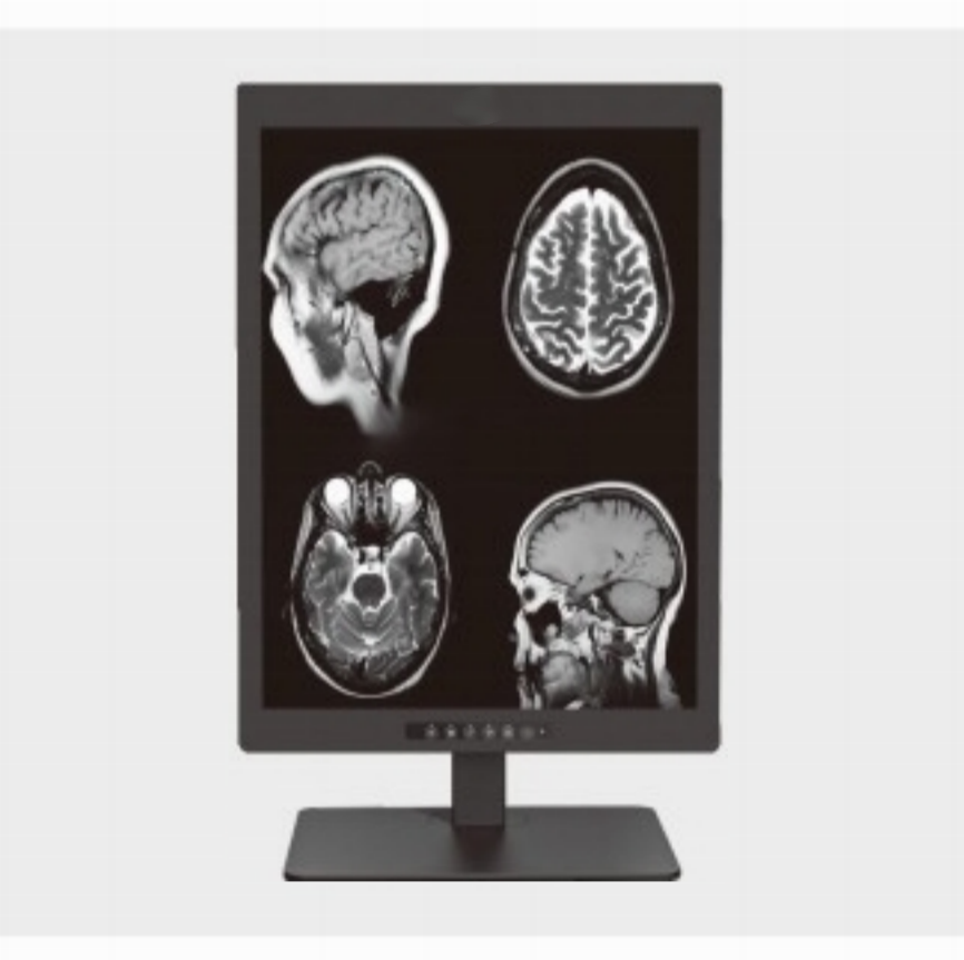 Di manakah Paparan Diagnostik Perubatan 2MP 20.1 inci yang Biasa Digunakan?