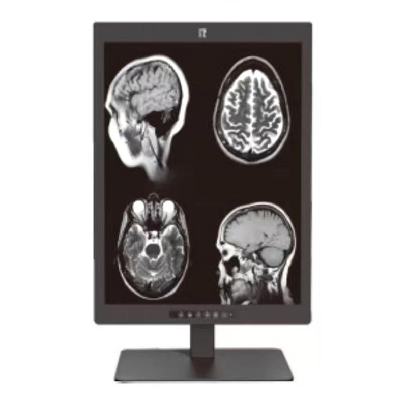 Monitor Diagnostik Perubatan 3MP 21.3 inci