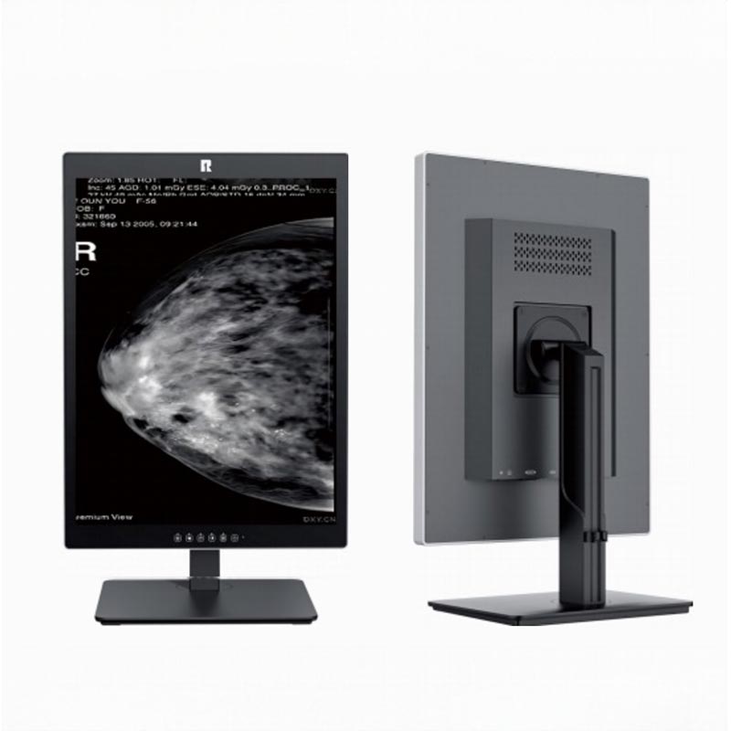 Monitor Diagnostik Perubatan 5MP 21.3 inci
