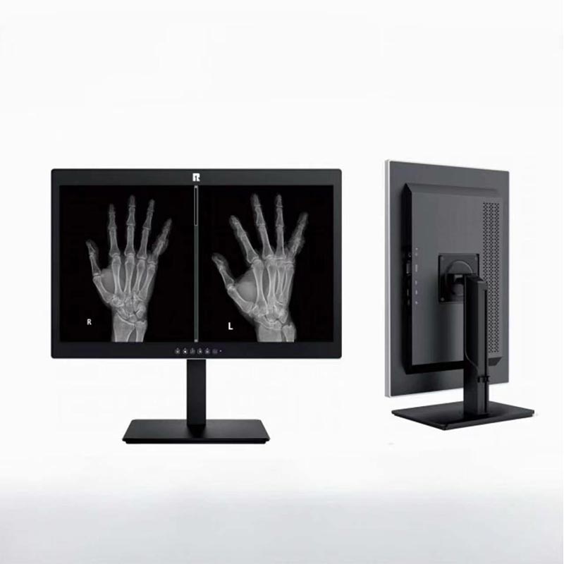 Monitor Diagnostik Perubatan 2MP 24-inci