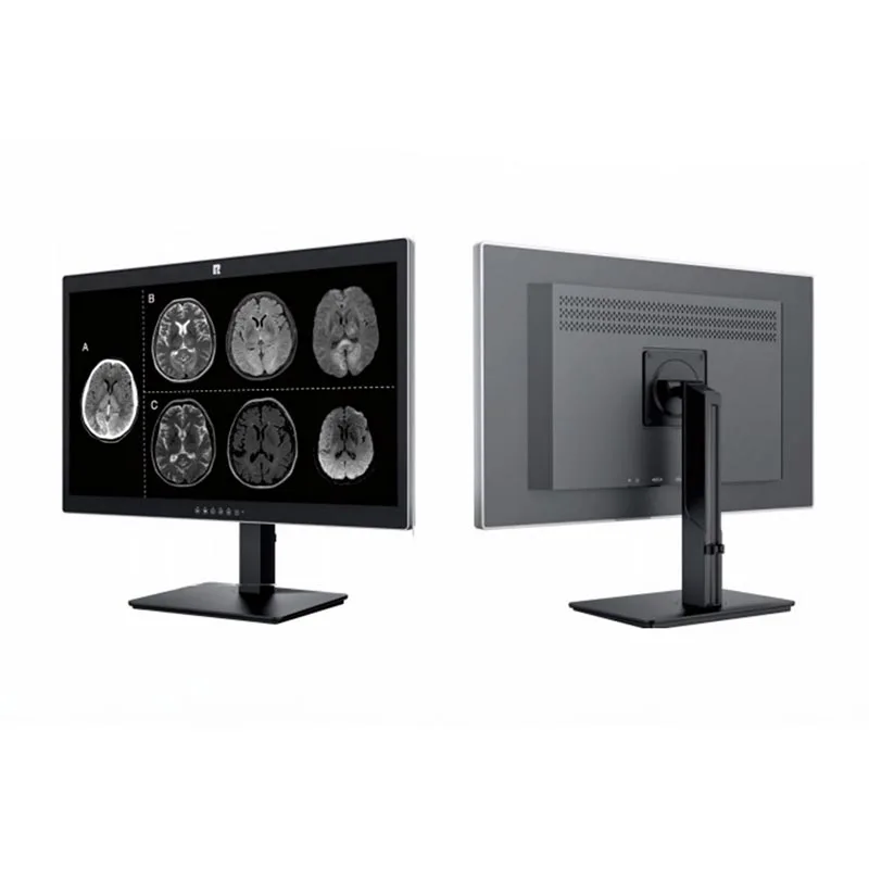 Monitor Diagnostik Perubatan 27-inci 8MP