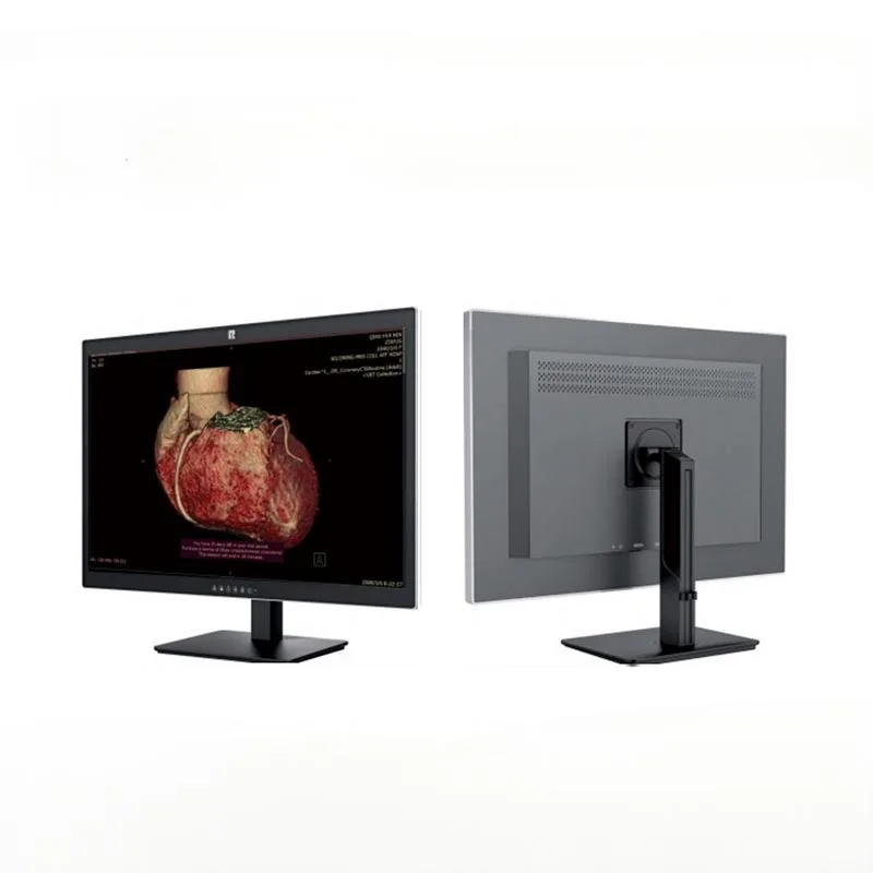 Monitor Diagnostik Perubatan 30-inci 6MP