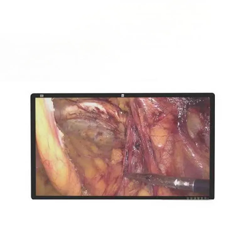 Monitor Perubatan Pembedahan 32-inci 4K