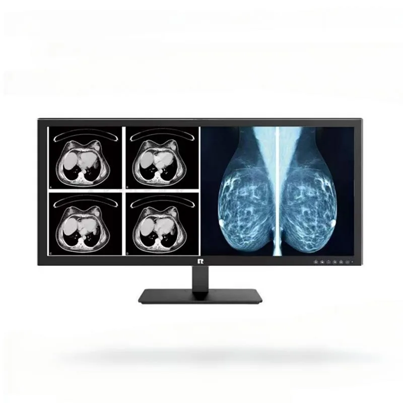 Monito Diagnostik Perubatan 34-inci 5MP