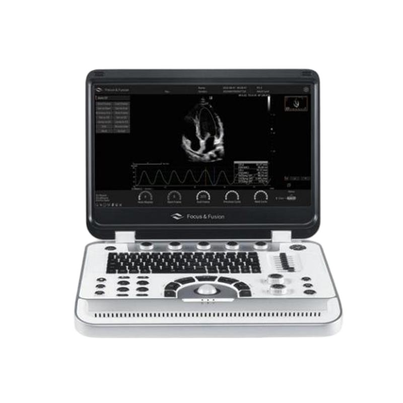 Portable Ultrasound Machine