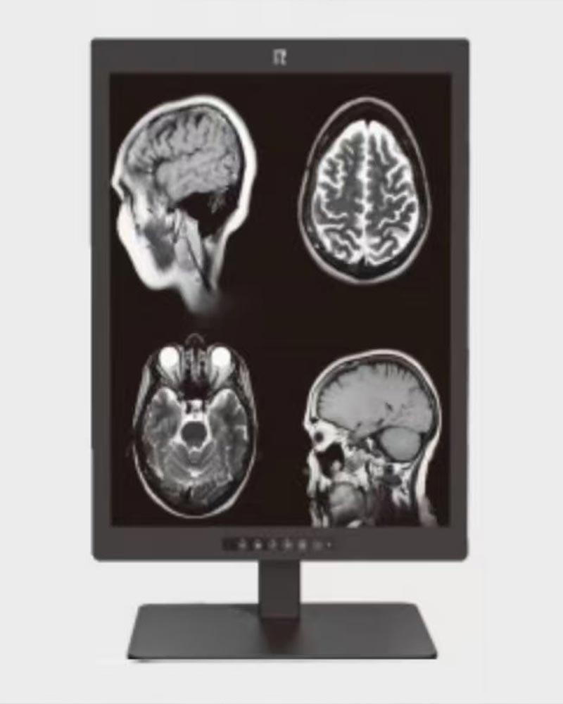 21.3-inch 3MP Medical Diagnostic Monitor