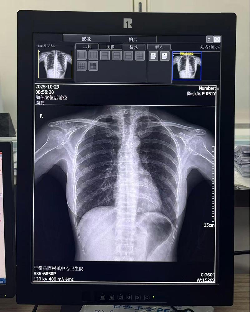 21.3-inch 3MP Medical Diagnostic Monitor
