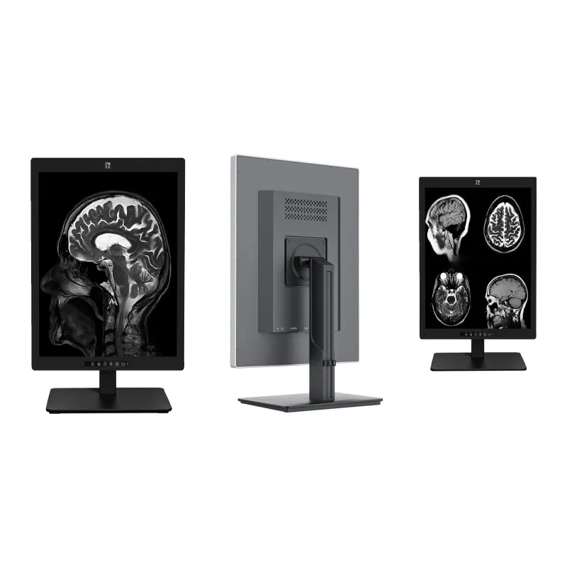 21.3-inch 3MP Medical Diagnostic Display