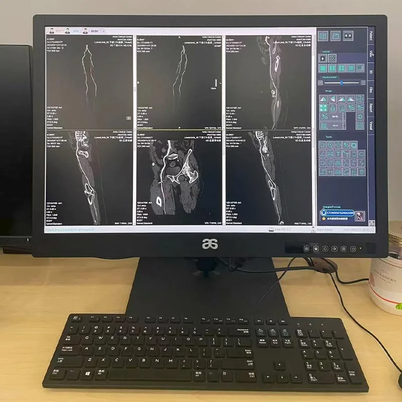 24-inch 2MP Medical Diagnostic Display
